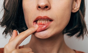 Woman with red and swollen gums