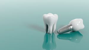 Molar and dental implant on green background